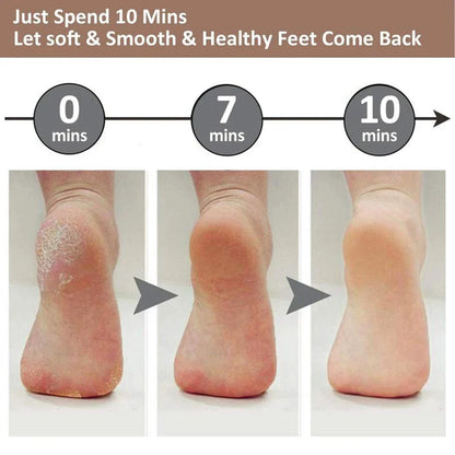 Electric Callus Remover