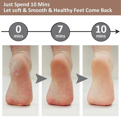 Electric Callus Remover